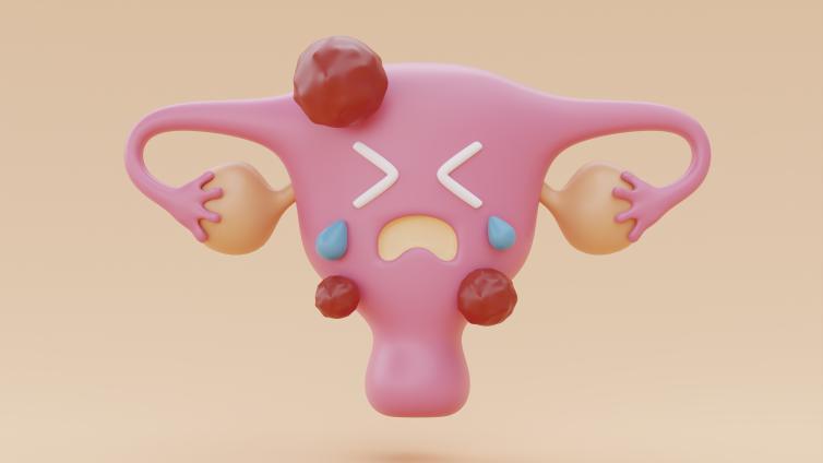 Sick Uterus